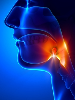 MOXATAG Tablets are a once-a-day combination therapy that uses the antibiotic amoxicillin.