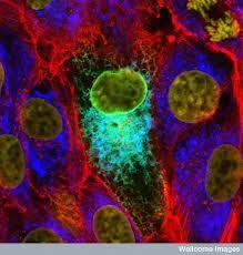 Mumps cases continue to spread in Illinois.