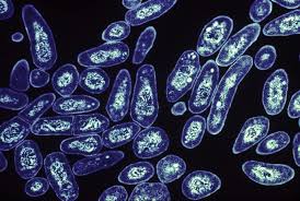 1000 tuberculosis cases in Europe